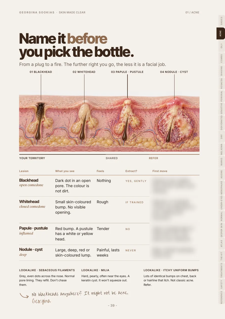 Acne lesion illustration page from blackhead to nodule, with the first-move column blurred