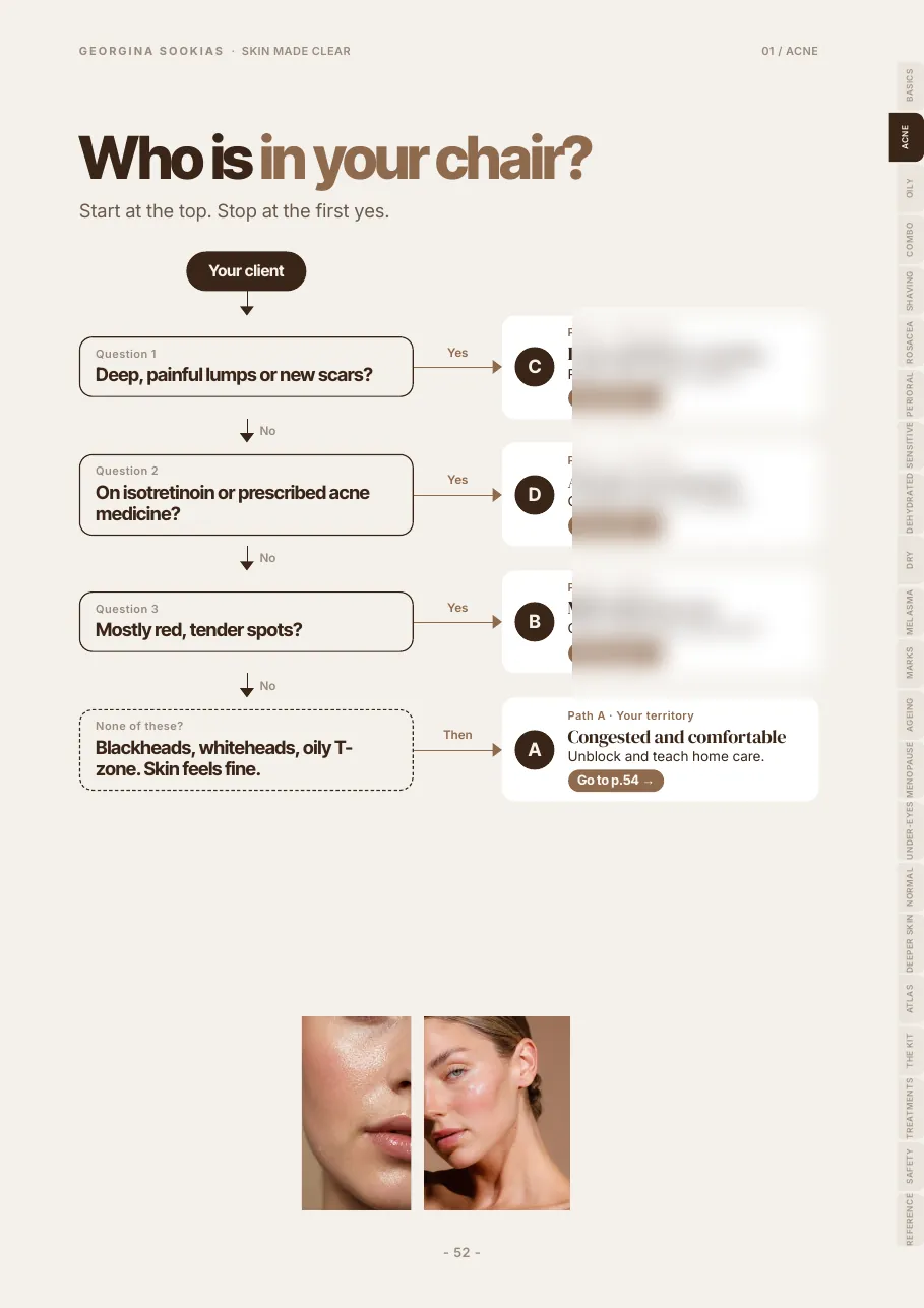 Acne pick your client flowchart, with three of the four paths blurred