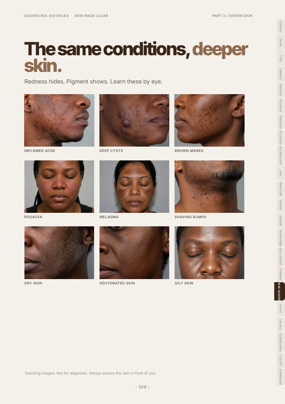 Grid of nine skin conditions shown on deeper skin tones, labelled as AI teaching images
