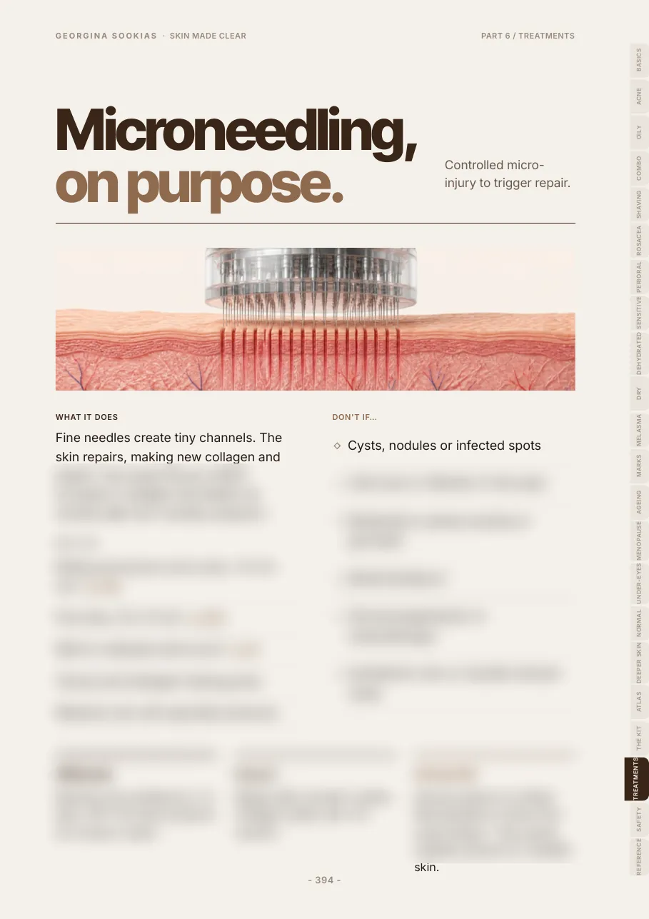 Microneedling treatment page with a skin illustration, with the detail blurred