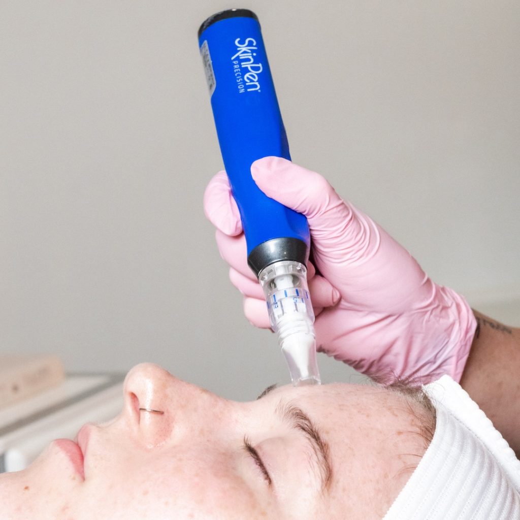 SkinPen Precision professional microneedling device
