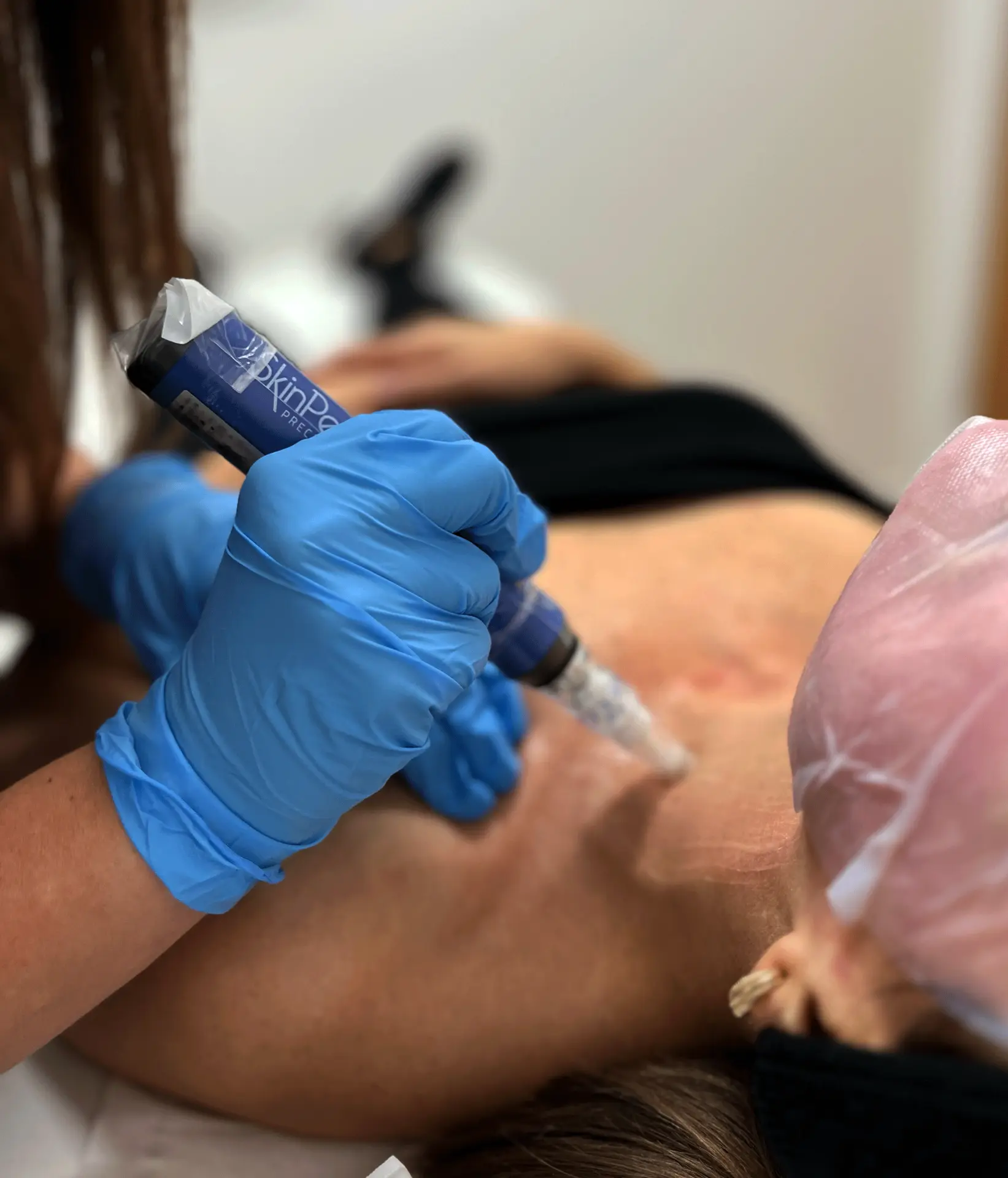 A SkinPen Precision microneedling treatment in progress, the sterile device worked across the skin at Georgina's Fulham studio